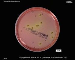 staphylococcus aureus and s.epidermidis on mannitol salt agar, Chapman agar